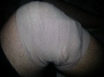 Knee Injury